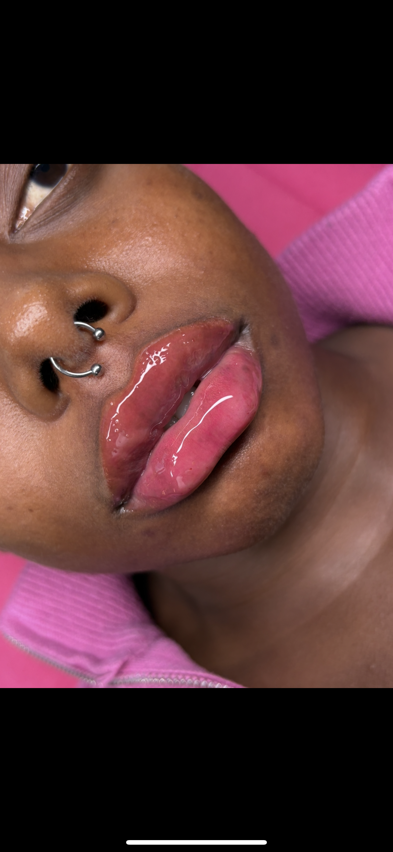 Ultimate #1 Viral Needle-Free Filler Blueprint – Sanai Cosmetics Signature Training